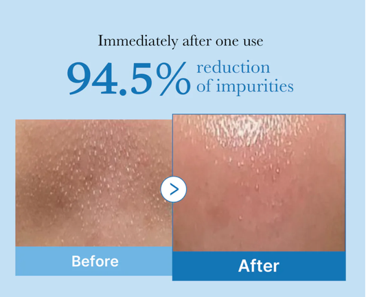 Medicube Zero Pore Blackhead Deep Cleansing Oil