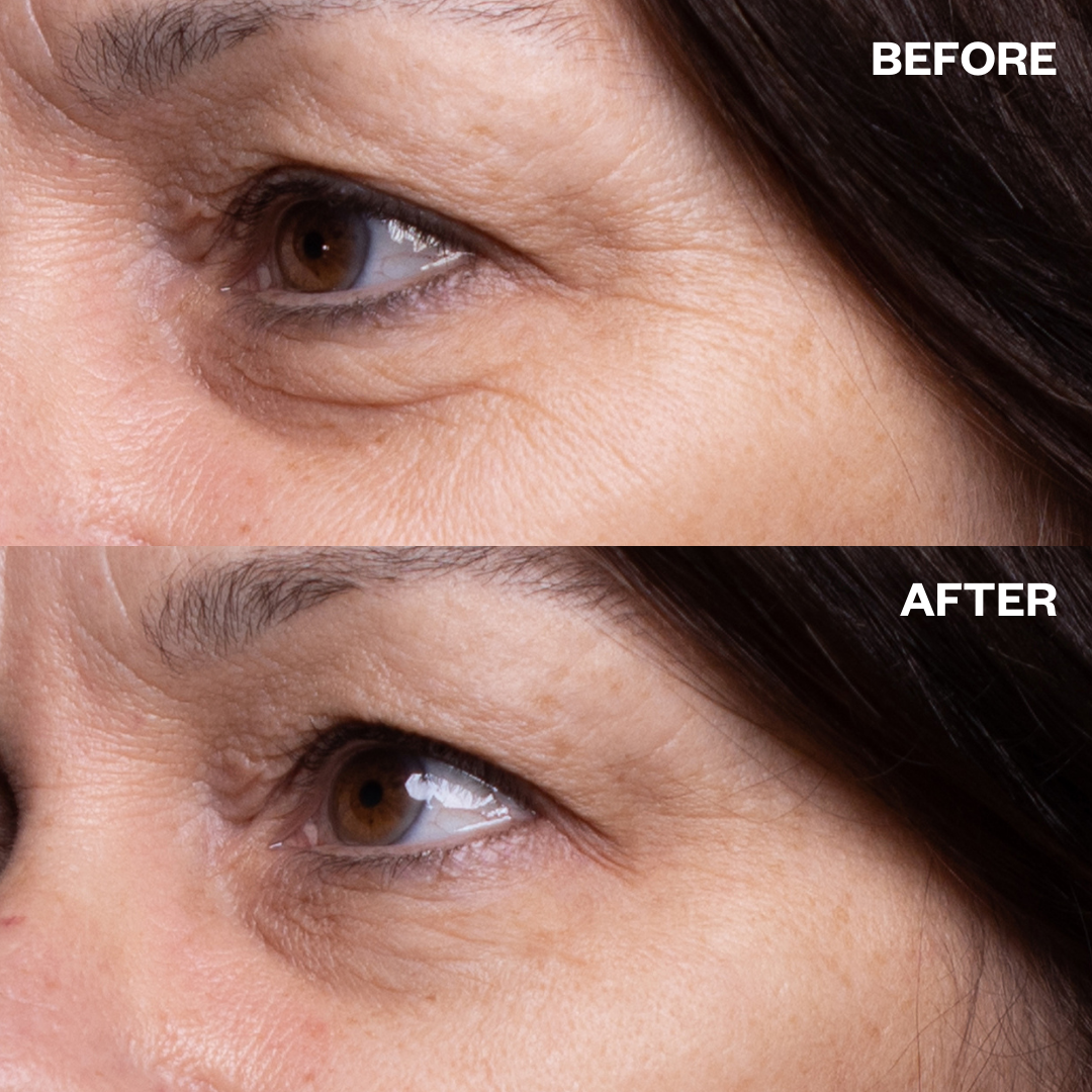 Wrinkles Schminkles Eye Wrinkle Patches