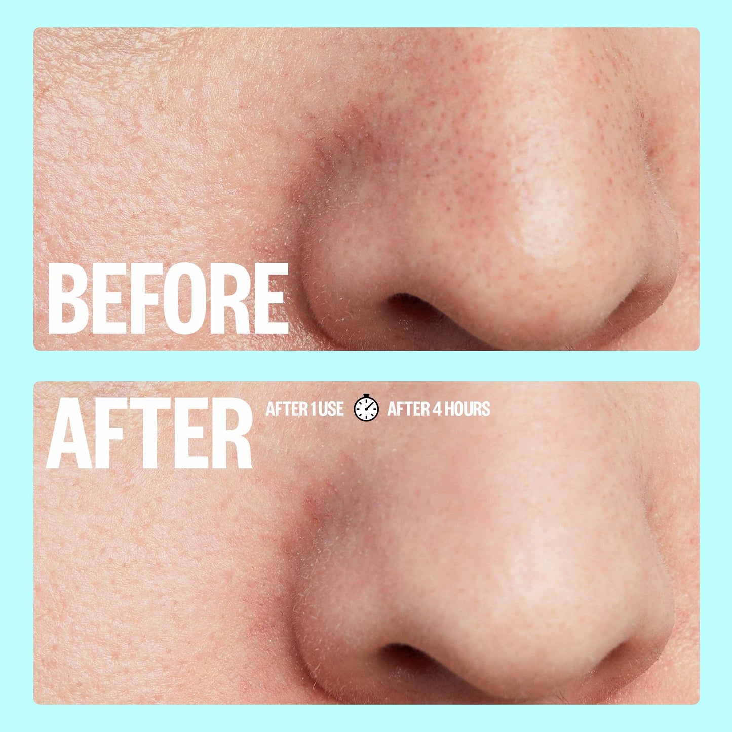 Peace Out Skincare Pore Minimizing Strips