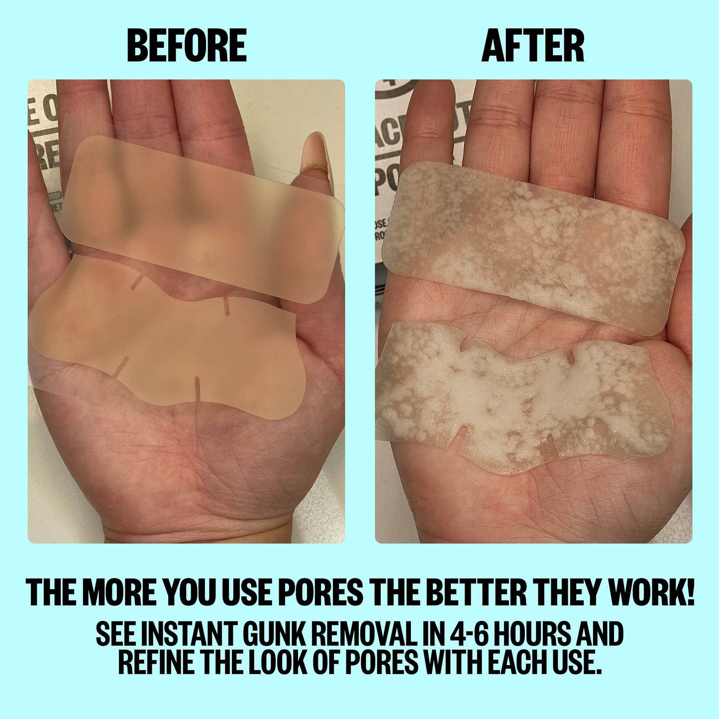 Peace Out Skincare Pore Minimizing Strips