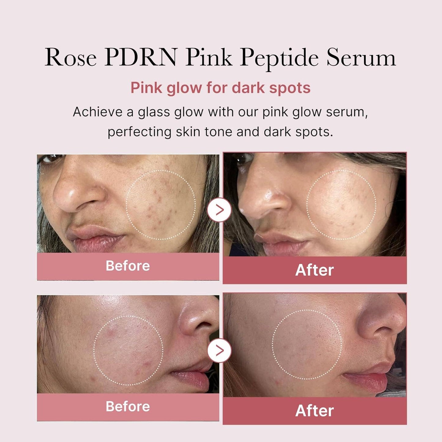 Medicube Salmon DNA PDRN Pink Peptide Serum