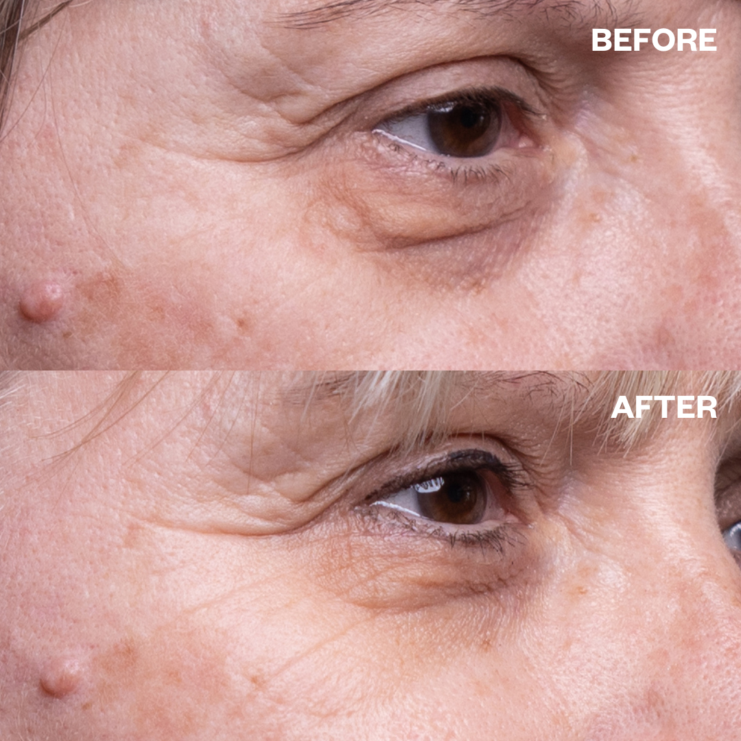 Wrinkles Schminkles Eye Wrinkle Patches – One Pair
