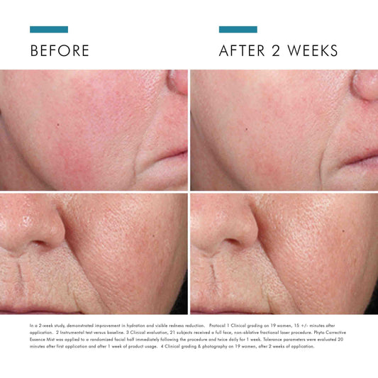 Phyto Corrective Essence Mist