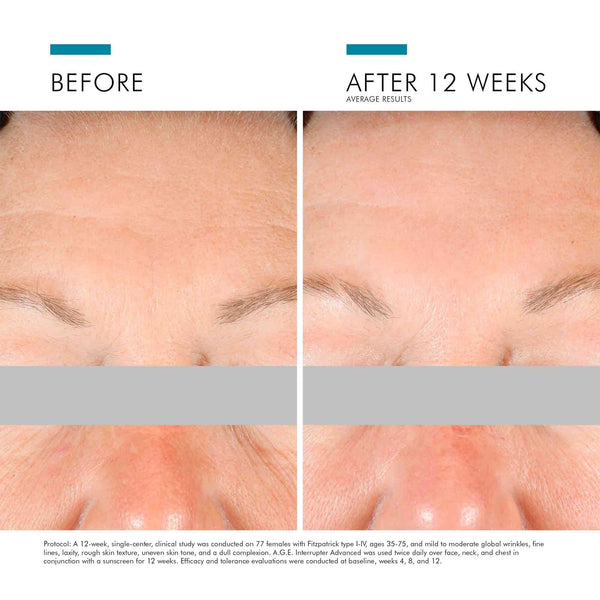 Interrupter Advanced Cream